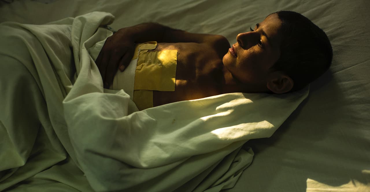 A boy with a large dressing on his abdomen lies in a bed