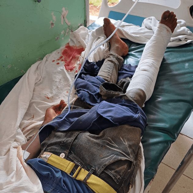 A teenager lies in hospital bed with a broken and bloody leg after an alleged attack by Del Monte guards